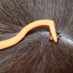How to Remove a Tick from Your Dog Safely and Completely